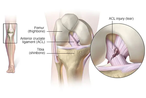 ACL and PCL