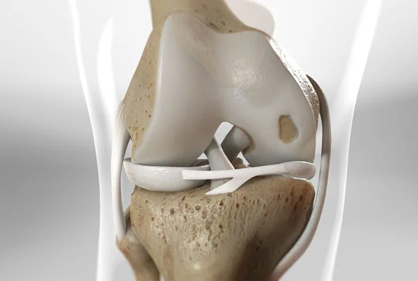 Cartilage