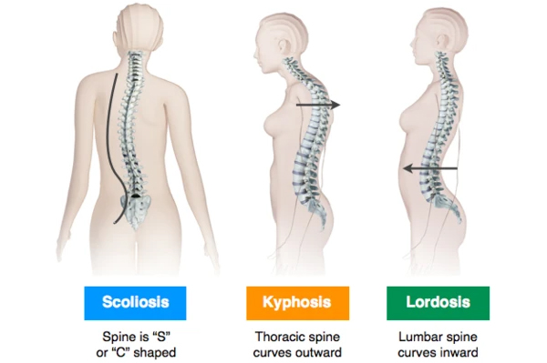 Spine